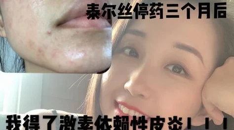 娜维娅焯出白水是指通过高温快速烫煮的方式去除食材中的杂质和异味，使其变得清澈透明
